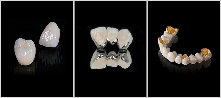 Animated teeth - DENTSPLY Cercon